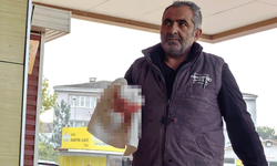 Bursa'da kesim makinesi işçinin parmağını kopardı