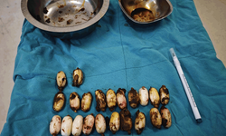 Eskişehir'de yabancı uyruklu şahıs zehirleri midesinde saklamaya çalıştı: Yakayı ele verdi