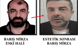 Ankara'da ameliyat ile yüzünü değiştiren zanlı, 7 yıl sonra yakalandı