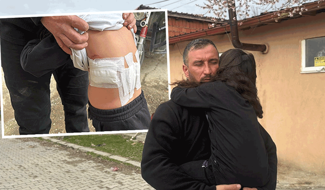 Afyon'da eşeğin saldırdığı çocuk ölümden döndü