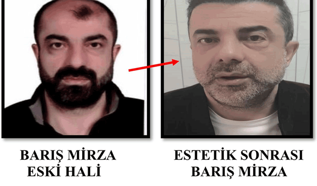 Ankara'da ameliyat ile yüzünü değiştiren zanlı, 7 yıl sonra yakalandı